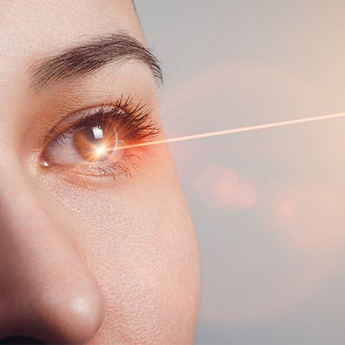 Imagenes secundarias – Cirugía refractiva con láser 1