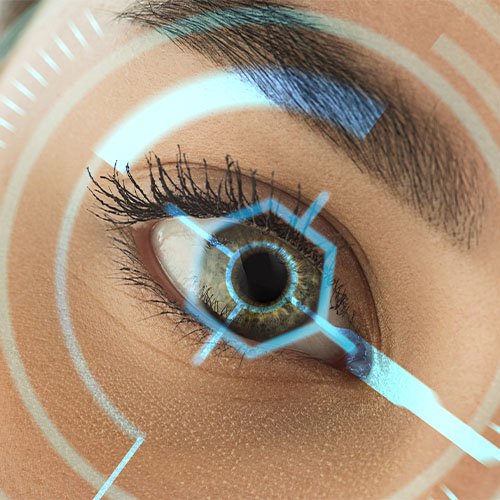 Imagenes secundarias – Cirugía refractiva con láser 2